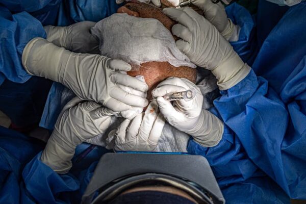 Hair Transplant