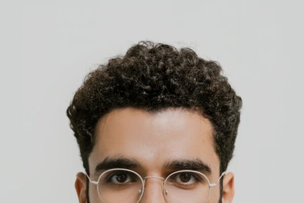 Hair Transplant