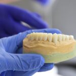 implantes dentales precio