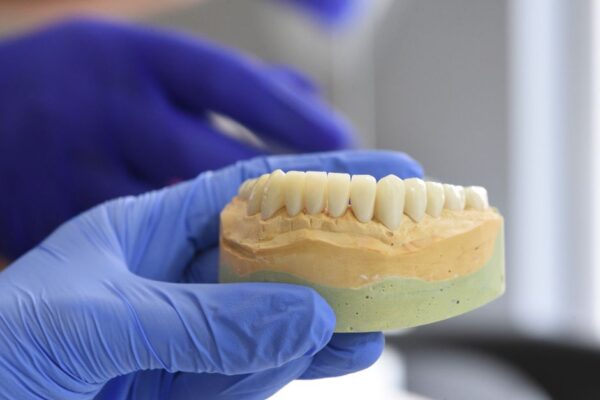 implantes dentales precio